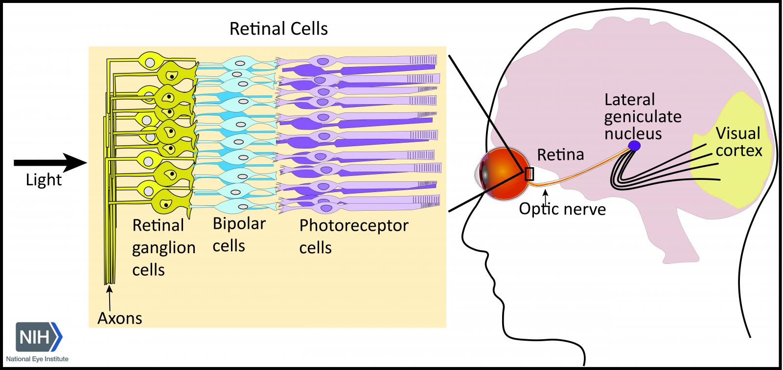 Scientists discover gene therapy provides neuroprotection to prevent vision loss